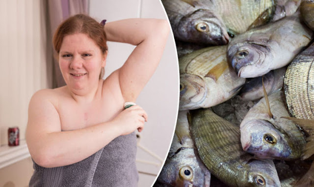Woman reveals she has to bath four times a day because she has a rare condition that makes her smell like fish