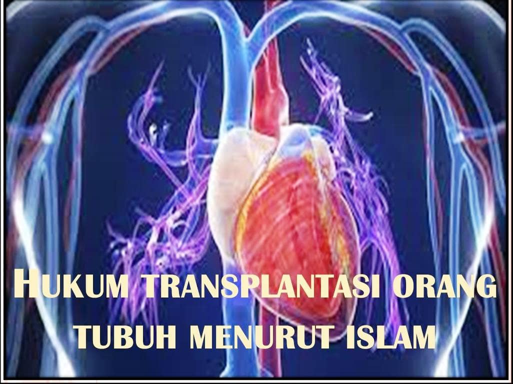 Transplantasi Organ Tubuh, Bolehkah Dalam Islam.???