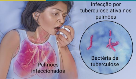 Manual de Recomendações para o  Controle da Tuberculose no Brasil 2018