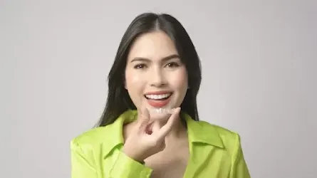 Pentingnya pasang behel gigi