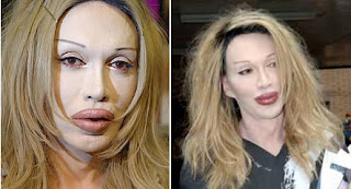 Hang Mioku,Michael Jackson,Dennis Avner,Jocelyn Wildenstein,Pete Burns,Surgery Disasters ,Horrible Cosmetic,