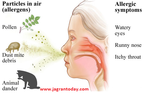 Symptoms of All Type of Allergy and Protection from Them