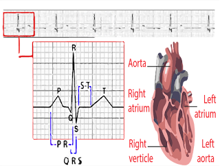 ECG