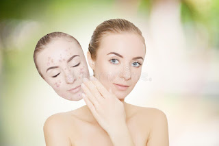 12 DIY Natural REMEDIES-How To Get Rid Of Dark Spots on Face, dark spots face images