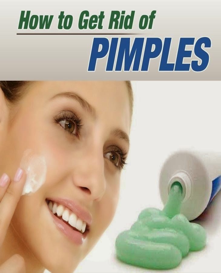 How to Get Rid of Pimples Fast | Simple Ways To Remove ...
