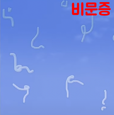 백내장-비문증