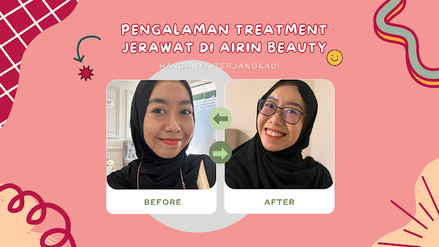 treatment-di-airin-beauty