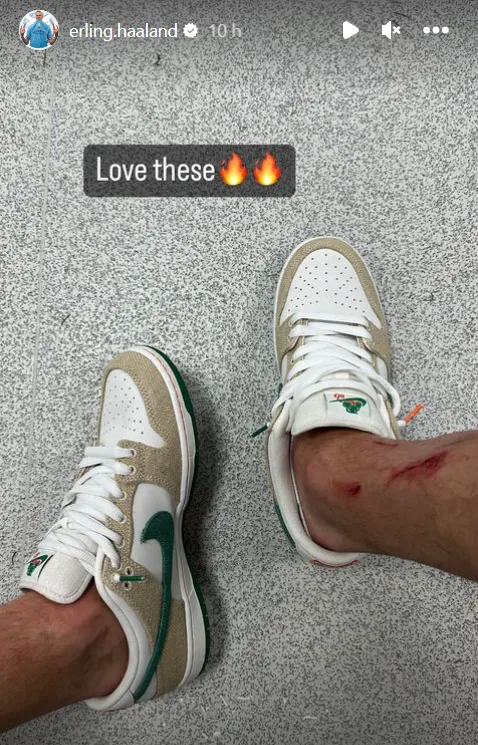 Erling Haaland shows off nasty cuts to leg after Man City’s draw at Brighton