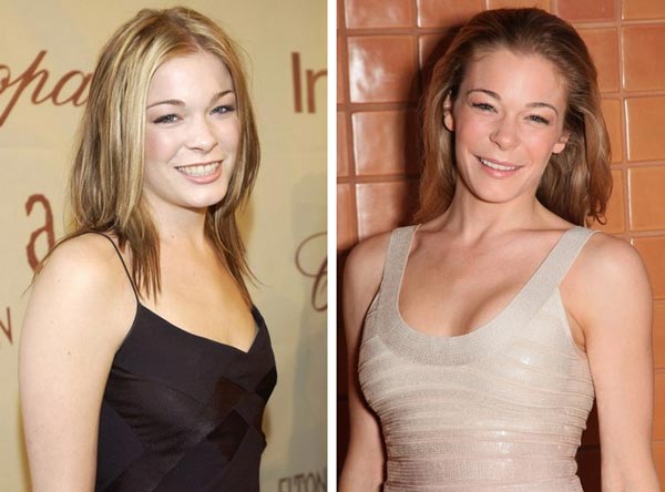 LeAnn Rimes Breast Enhancemen