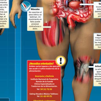 Flacos y gordos - infografia - Oliver Leon - Dibujando por Dinero