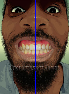 Правильная средняя линия зубов