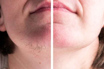 You Need Just 15 Minutes To Remove All Your Facial Hair