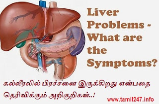 Kalleeral pirachanai arikurigal - Symptoms of Liver Disease, Udal nalam kurippugal, Udal nalam kappom, health tips in tamil, liver damage symptoms in tamil
