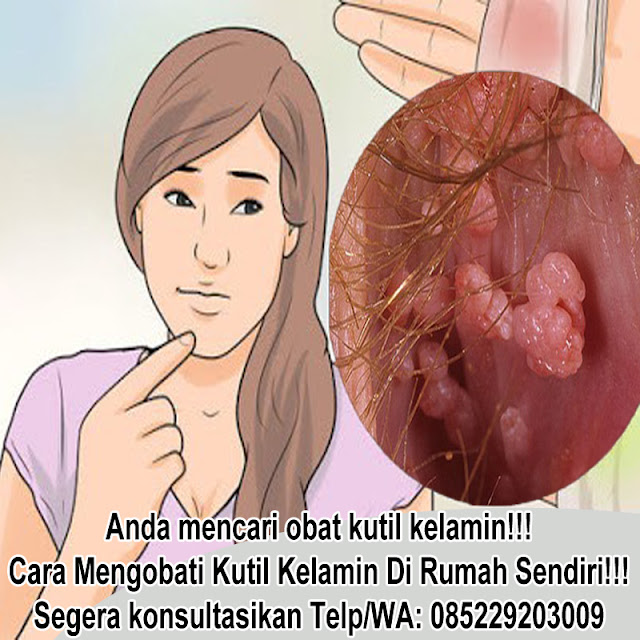 Obat Antibiotik Kutil Kelamin 1 Hari Rontok Termanjur