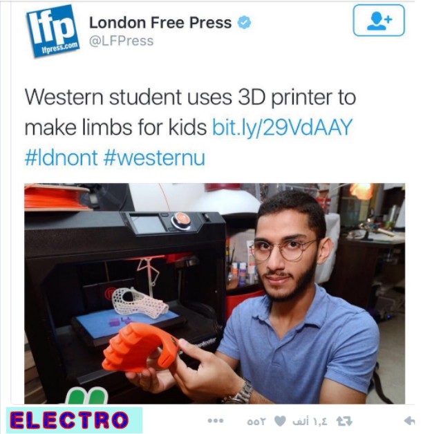 مبتعث سعودي يستخدم الطابعة 3D ثلاثية الأبعاد لمساعدة أطفال الحروب
