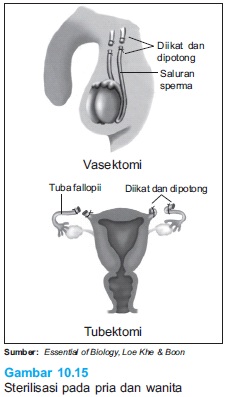 Kekinian Gambar Alat Kontrasepsi