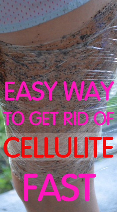 Easy way to get rid of Cellulite fast