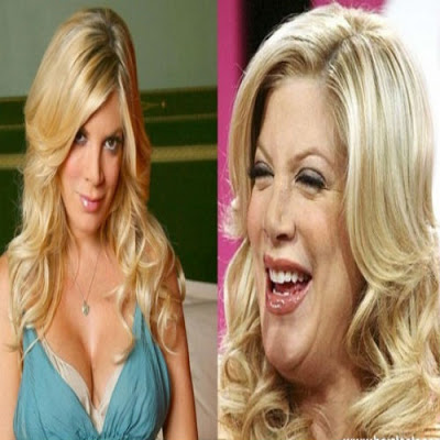 fotos-de-famosas-que-ja-fizeram-botox