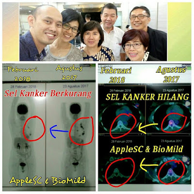 testimoni biogreen, bio stemcell gold, apple stem cell plus, harga apple stem cell, biogreen apple stem cell harga, testimoni apple stem cell, harga apple stemcell plus, testimoni apple stem cell plus, testimoni biogreen apple stem cell, apple stem cell testimoni, apple stem cell plus biogreen, harga biogreen science, jual apple stem cell murah, stem cell apel, khasiat apple stem cell plus