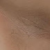 Changes On The Skin That Can Radically Change Your Life: Many Of You Don’t Know That This Is A Symptom Of…