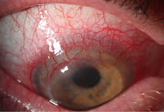 clinical experimental ophthalmology journal