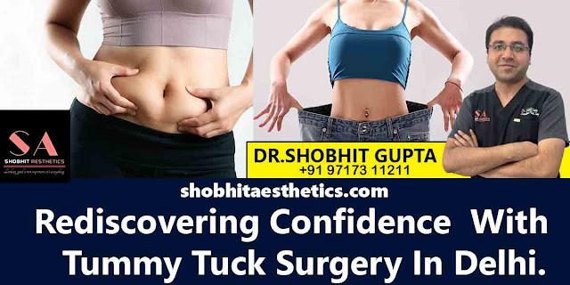 Tummy tuck surgery in Delhi