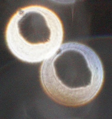 orb rings