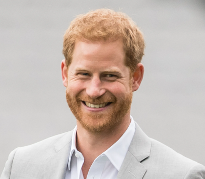 prince harry hair loss