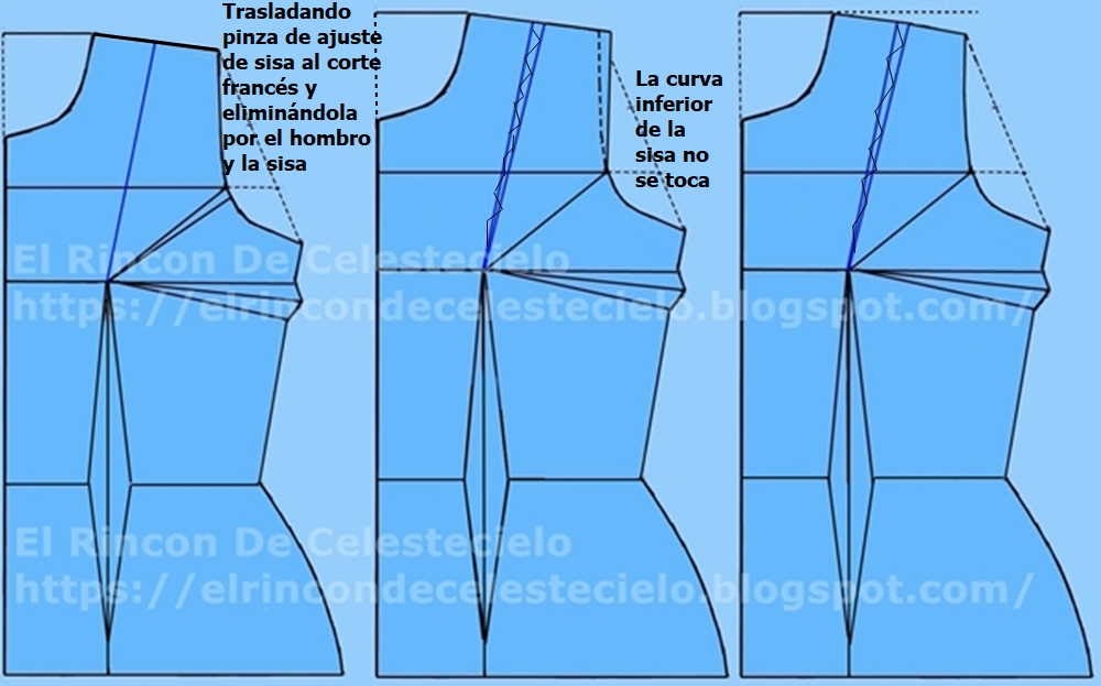 Forma de eliminar la pinza de ajuste de sisa por el hombro mediante el corte francés