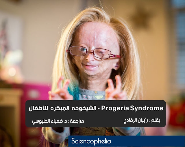 الشيخوخة المبكرة لدى الأطفال   progeria - ساينسوفيليا