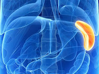 Cara Mengobati Limpa Bengkak / Splenomegali Dengan Obat Tradisional, Terbukti Manjur