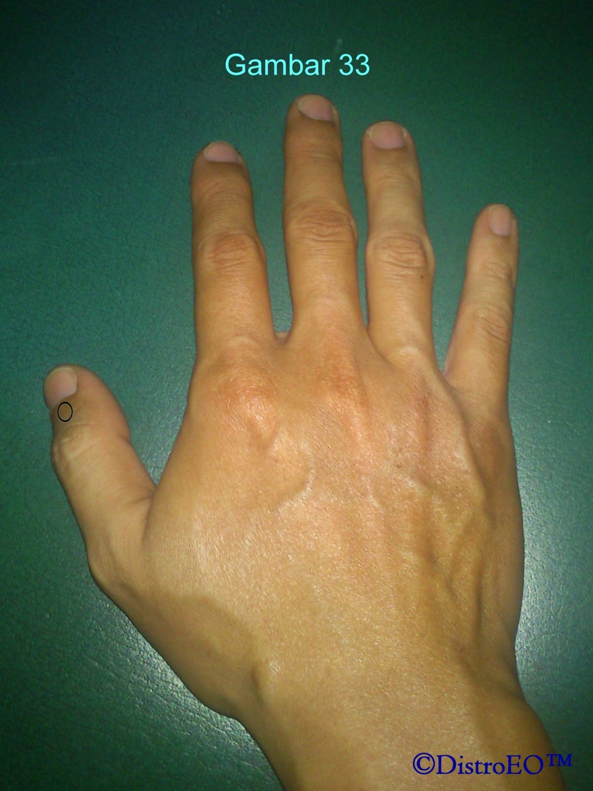 Titik Telapak Tangan (3T) dan manfaatnya Orgonite 3T (bagian 3)