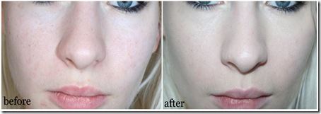 revlonba