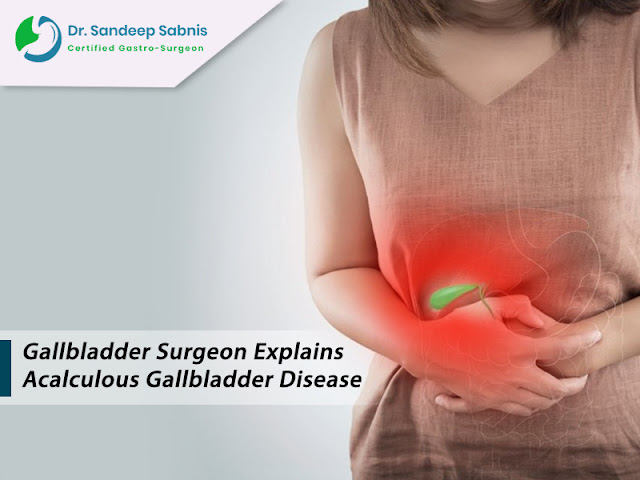 Acalculous Gallbladder Disease