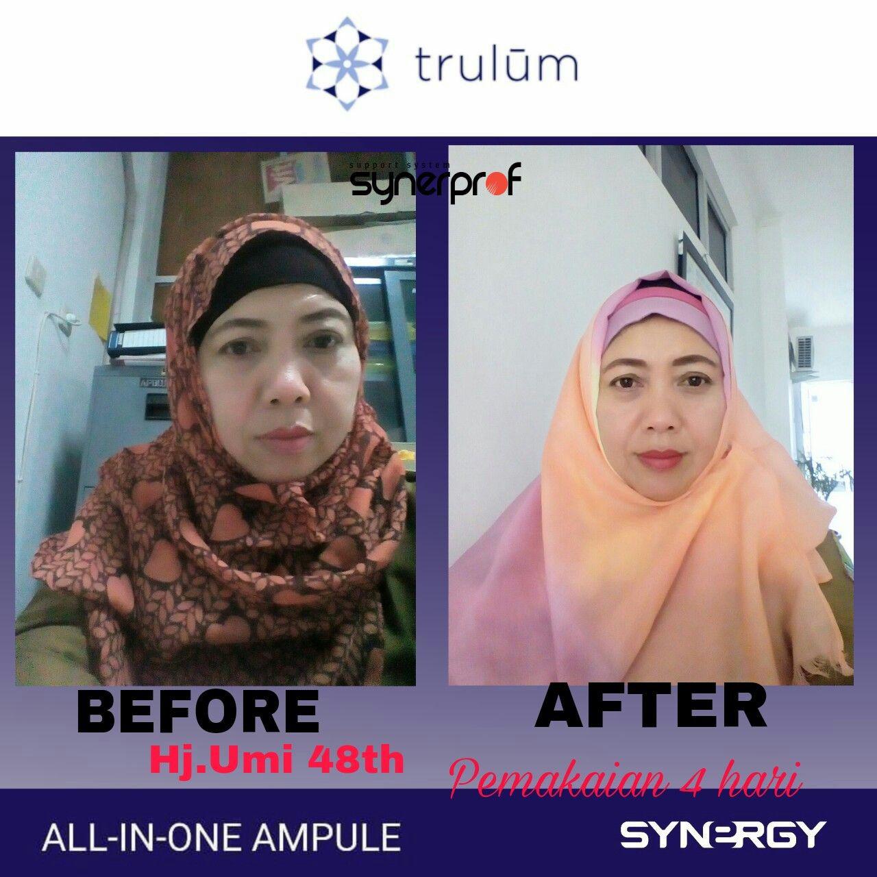 Klinik Kecantikan Trulum Skincare Di Daerah Jujuhan, Bungo WA: 08112338376