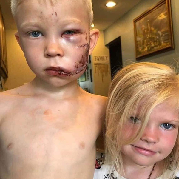 6 year old brother saved his 3 year old sister from certain death