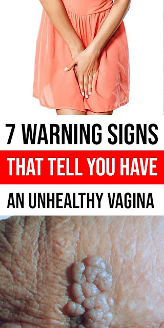 7 Warning Signs That Tell You Have An Unhealthy Vagina