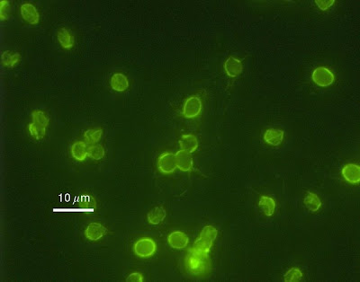 Cryptosporidium