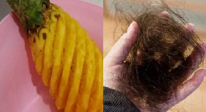 Rambut Rontok Berkurang, Ketombe Hilang, Rambut jadi Hitam Bercahaya, Hanya dengan Buah Nanas!