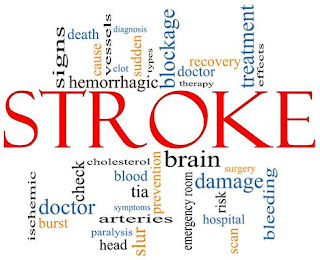 Obat tradisional untuk gejala stroke, Cara Mengobati Org Stroke, Mengobati Sakit Stroke Ringan, Obat Stroke Cepat Sembuh, Pengobatan Stroke Non Hemorrhagic, Www.Obat Stroke Alami, Obat Stroke Generik, Cara Pengobatan Stroke Mata, Pengobatan Stroke Dengan K-Link, Pengobatan Stroke Dengan Fisioterapi, Obat Stroke Pecah Pembuluh Darah
