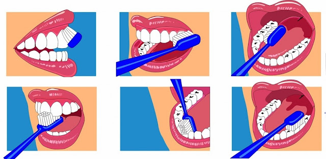Suggerimenti con alcuni metodi illustrativi su come posizionare lo spazzolino tra gengive e denti