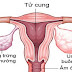 U nang buồng trứng và nghiên cứu điều trị