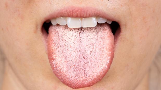 ¿Qué significa cuando tienes la lengua blanca y pastosa?