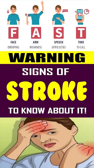Warning Signs of Stroke to Know About