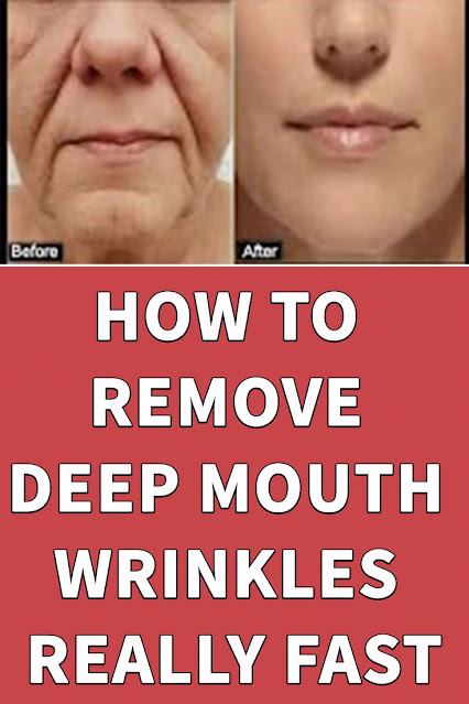 Do This Once A Week, And Say Goodbye To The Deep Wrinkles And Scars