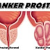10 Makanan Pencegah Kanker Prostat