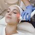 5 Benefits Of Laser Technology Skin Treatment!