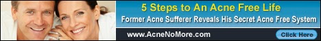 acne treatment