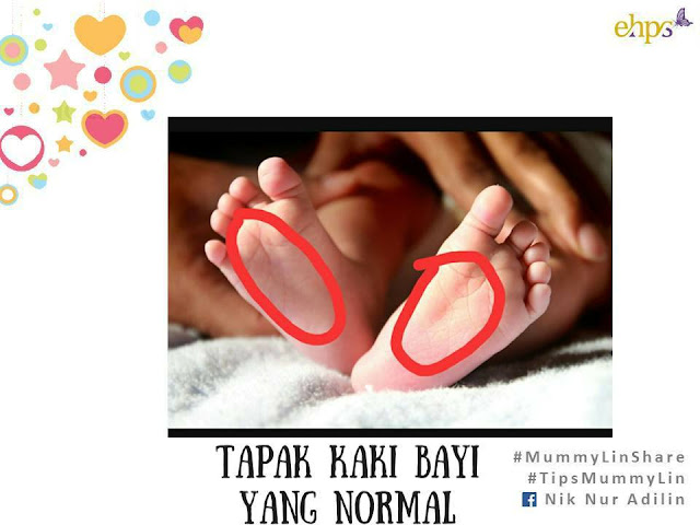 urutan bayi, cara mengurut bayi, urutan untuk perut kembung bayi