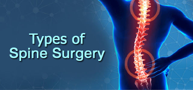  common types of spine surgery